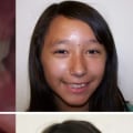 How Invisalign Can Correct Overbite