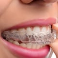 Is Invisalign more effective than braces?