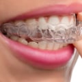 Which invisalign tray hurts the most?