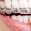 Can Invisalign Close Gaps and Improve Your Smile?