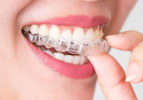 Why Invisalign Accessories are a Must for Your Orthodontic Treatment