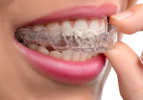 What is the Most Painful Week of Invisalign Treatment?