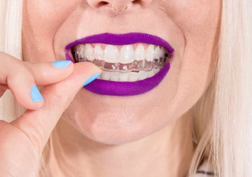 Who Owns Invisalign? Align Technology Explained